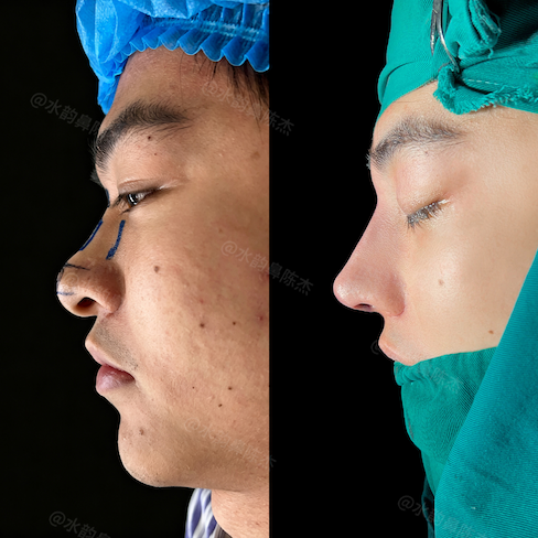 Case 1 - Photo 3