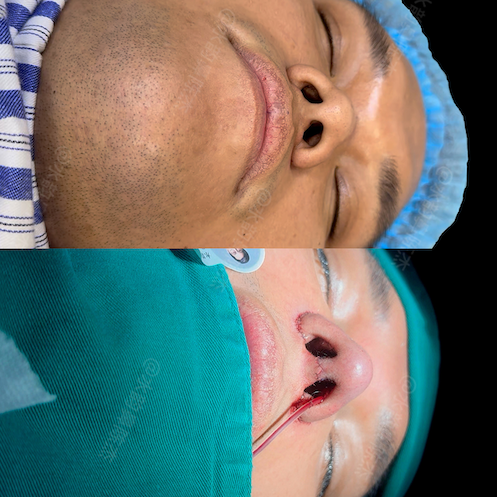 Case 4 - Photo 3